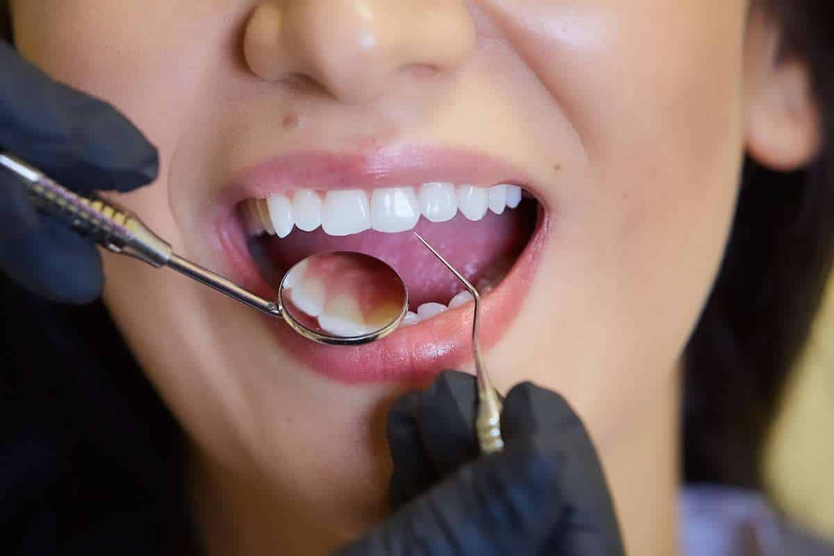 Dental